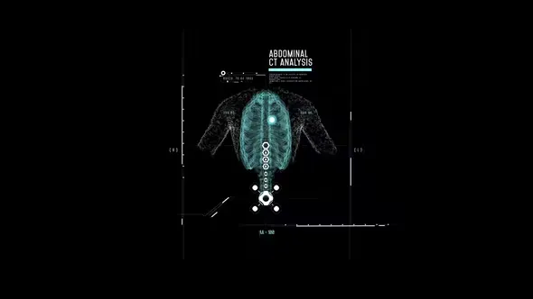 Videohive HUD Abdominal Analysis 44395348